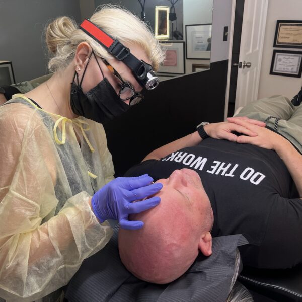 Men’s Lash line enhancement