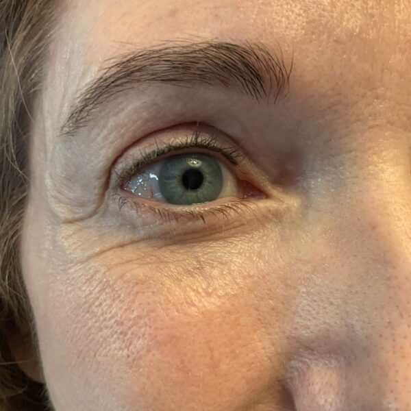 Lash enhancement